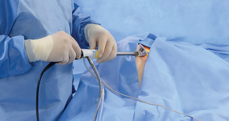Endoscopic Vessel Harvesting eLearning